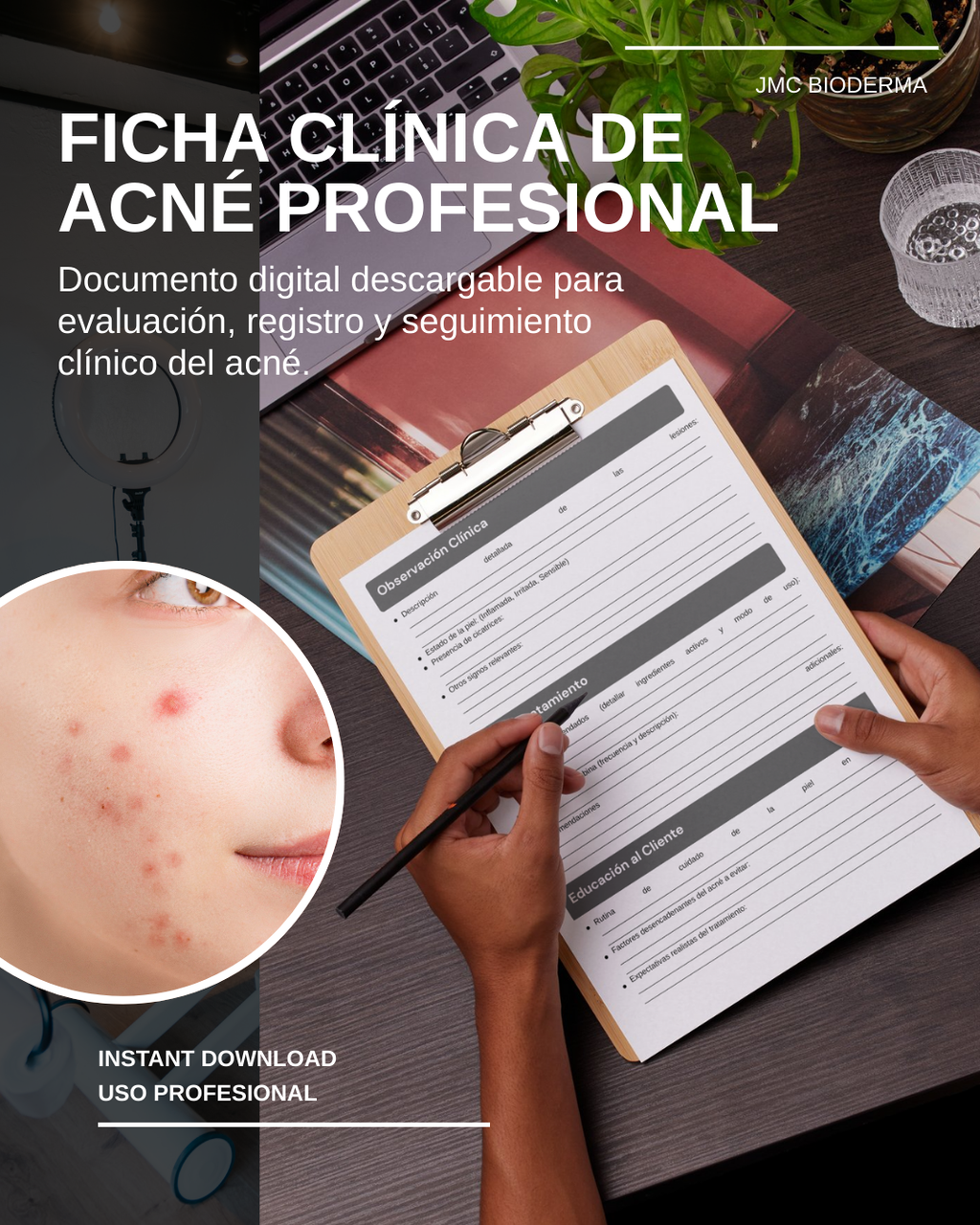 Ficha Clínica de Acné – Profesional