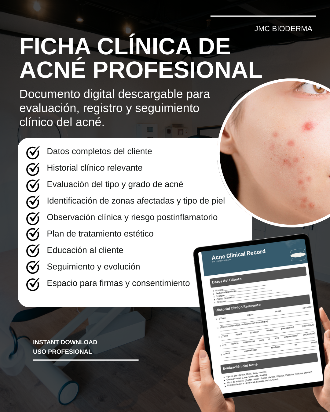 Ficha Clínica de Acné – Profesional